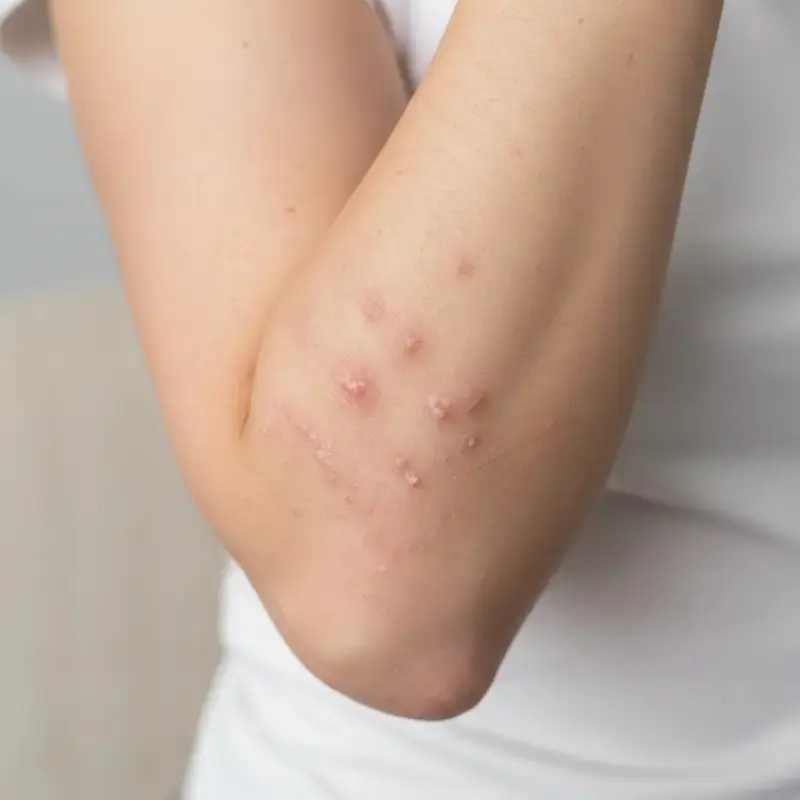 نوريفا زيروديان أي بي+ جل رغوي ناعم منظف 745 مل / Noreva Xerodiane AP+ Gentle Foaming Gel
